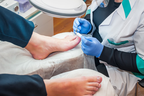 Toenail Fungus