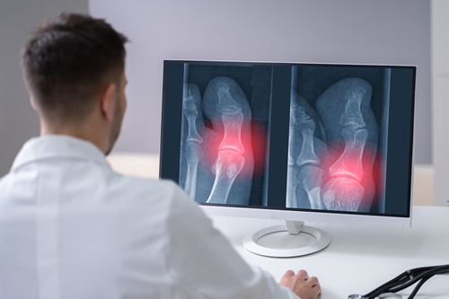 Digital X-Ray - Advanced Foot Care
