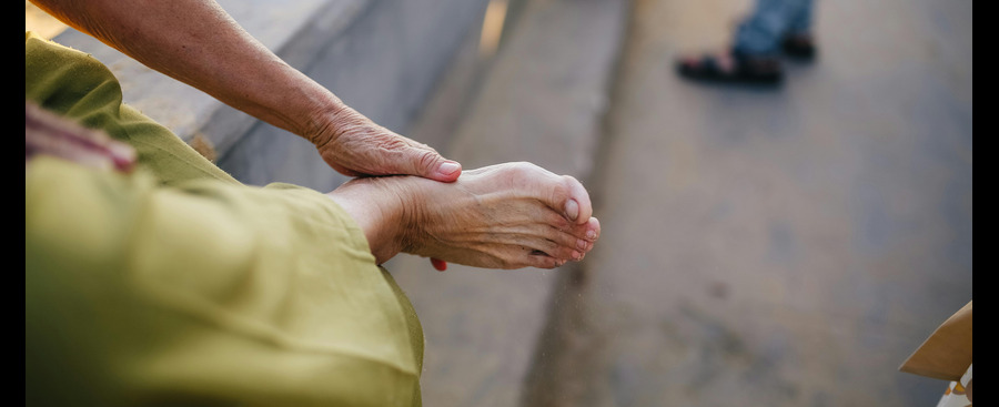 Raynaud’s Disease