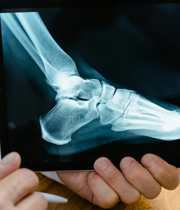 Foot Doctors Serving Long Beach, NY